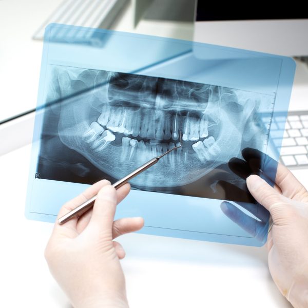 dentist analyzes x ray photo